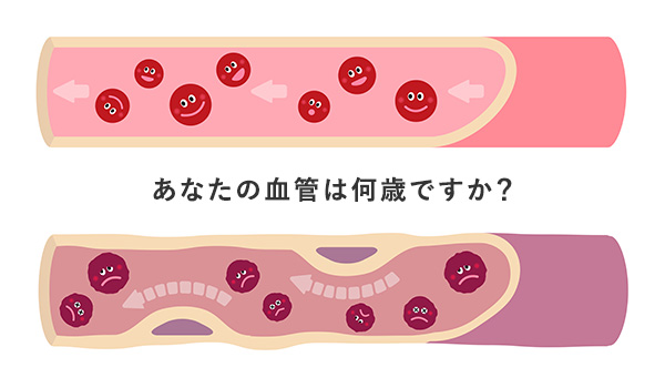 あなたの血管は何歳ですか？